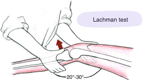 lachman test diagnosis